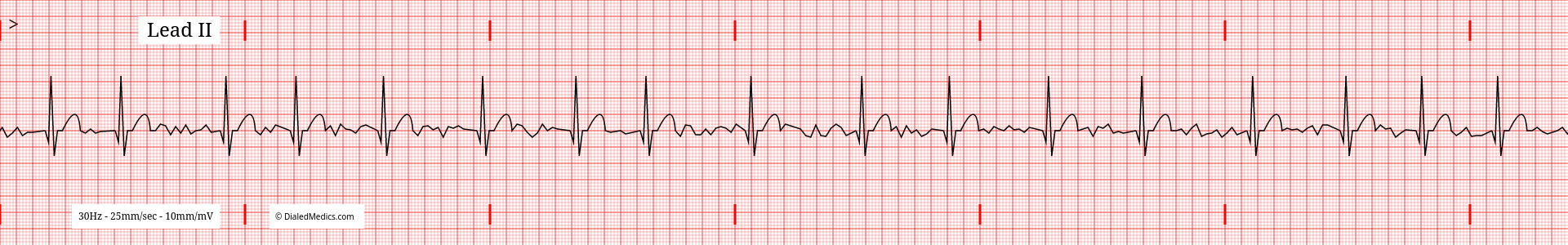 Our Solution: A software EKG generator