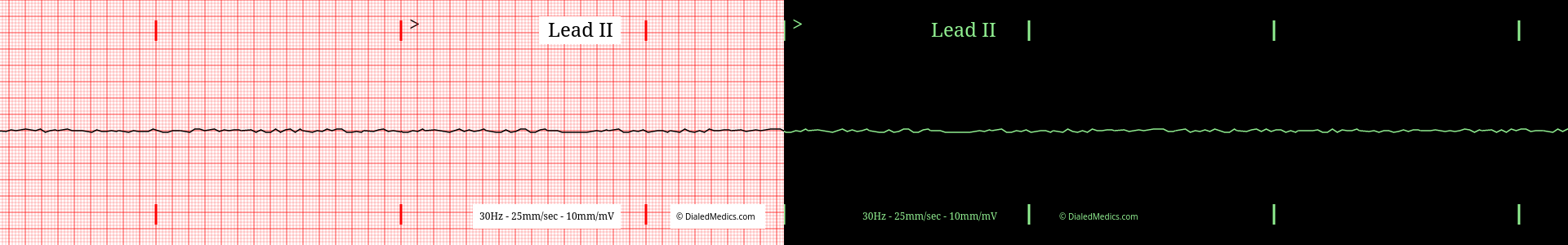 How To: EKG Simulator Quick Manual