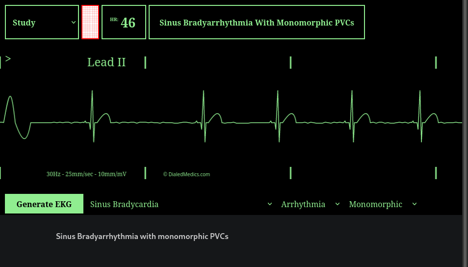 How To: EKG Simulator Quick Manual