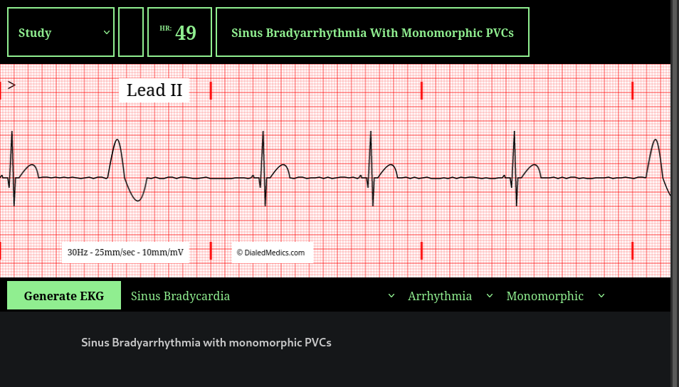 How To: EKG Simulator Quick Manual