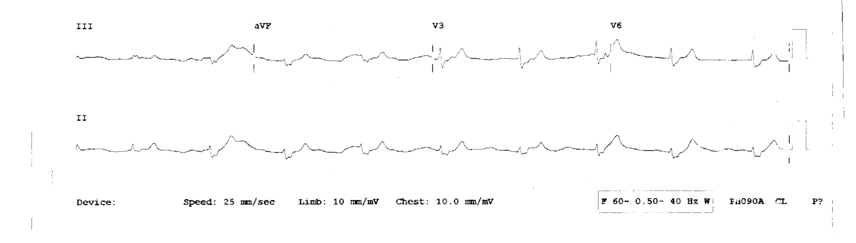 The Problem: How We Teach EKGs