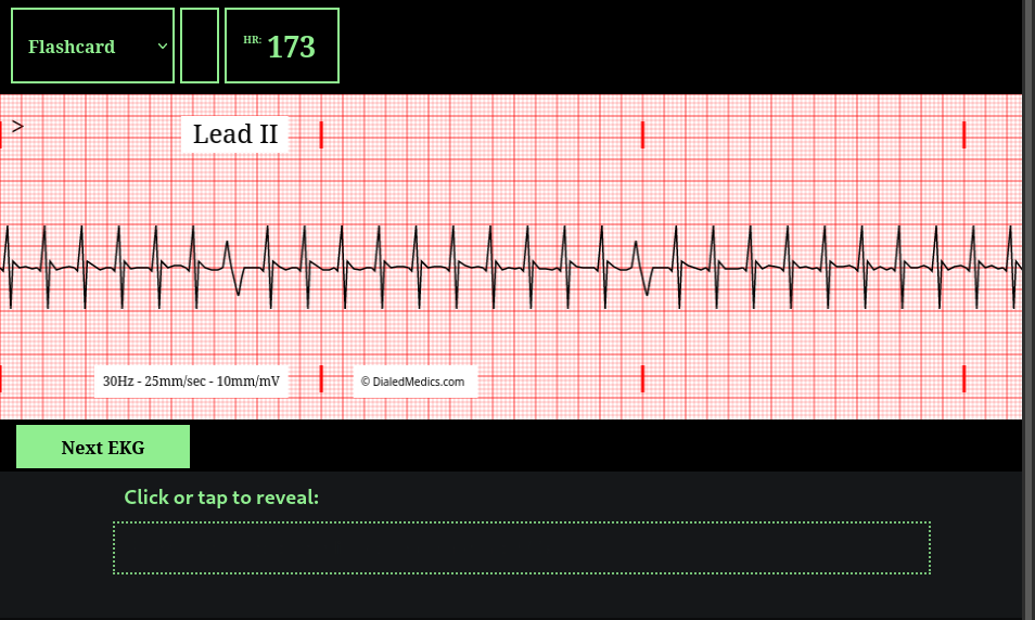 How To: EKG Simulator Quick Manual