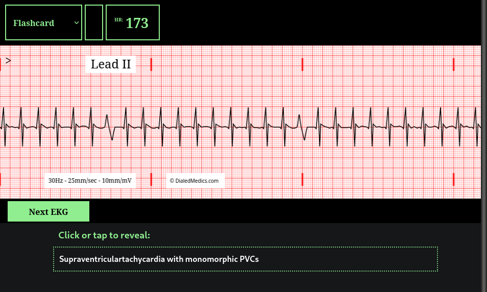 How To: EKG Simulator Quick Manual