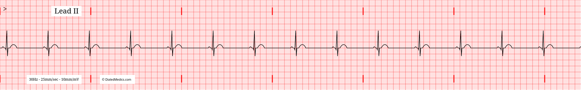 Our Solution: A software EKG generator