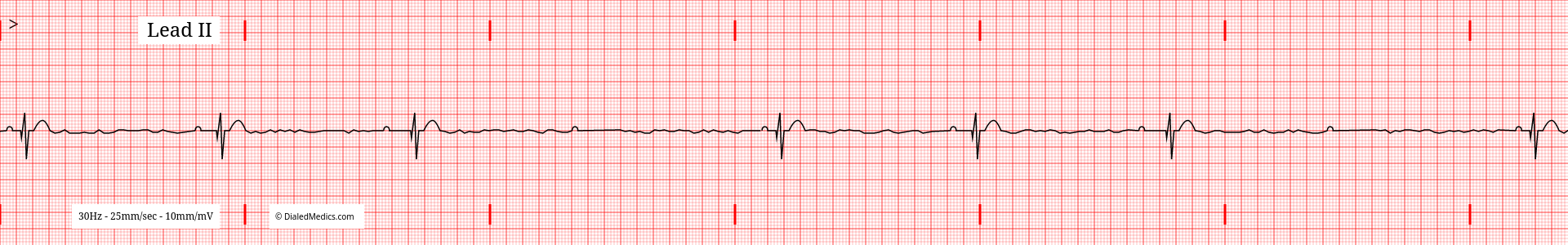 The Problem: How We Teach EKGs