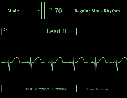 How To: EKG Simulator Quick Manual