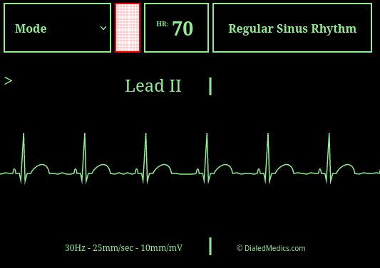 Our Solution: A software EKG generator