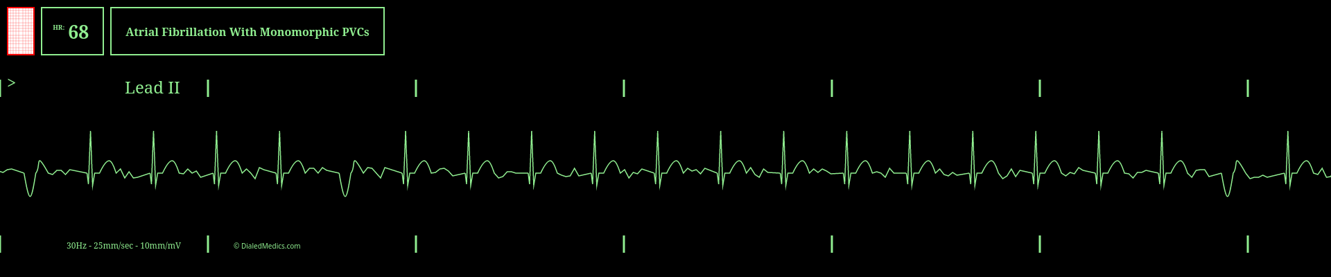 Our Solution: A software EKG generator