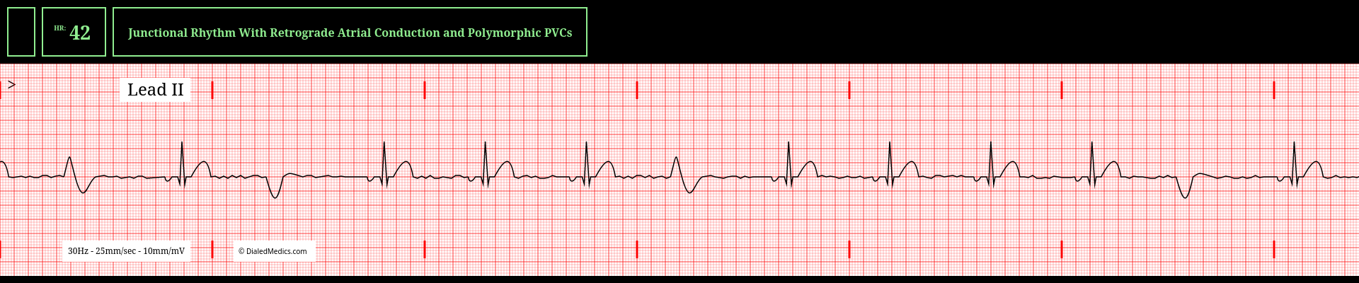 Our Solution: A software EKG generator