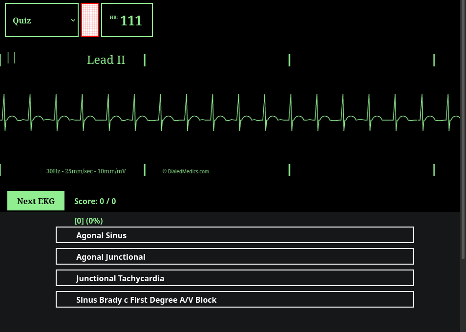 How To: EKG Simulator Quick Manual