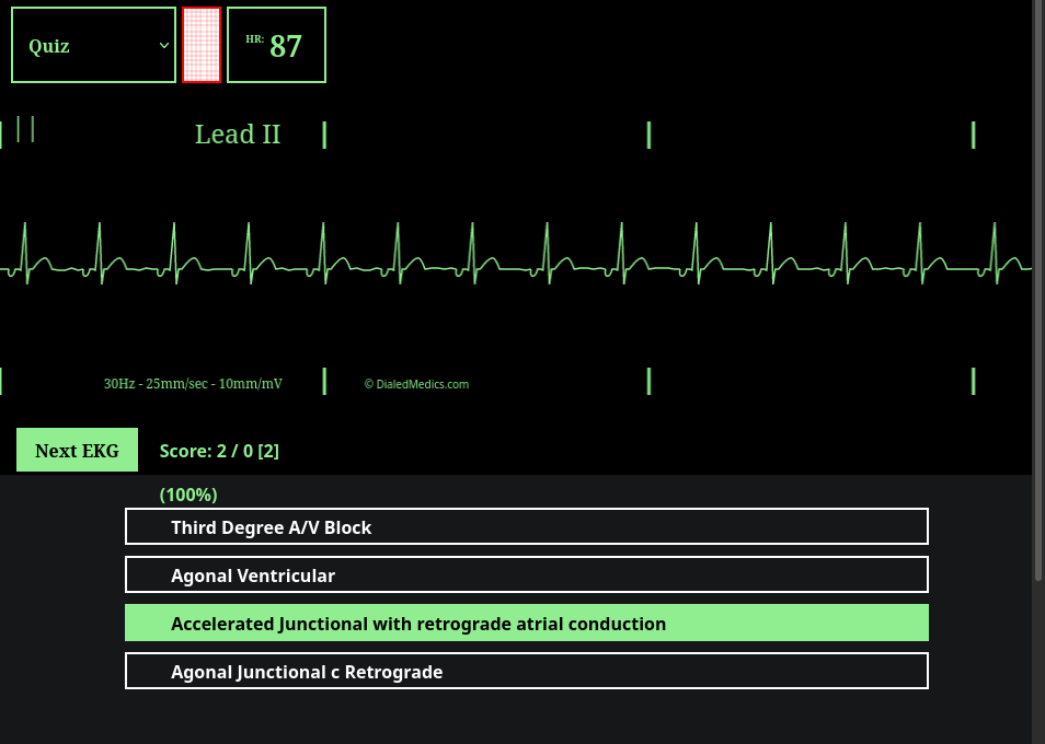 How To: EKG Simulator Quick Manual