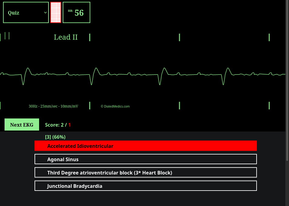 How To: EKG Simulator Quick Manual