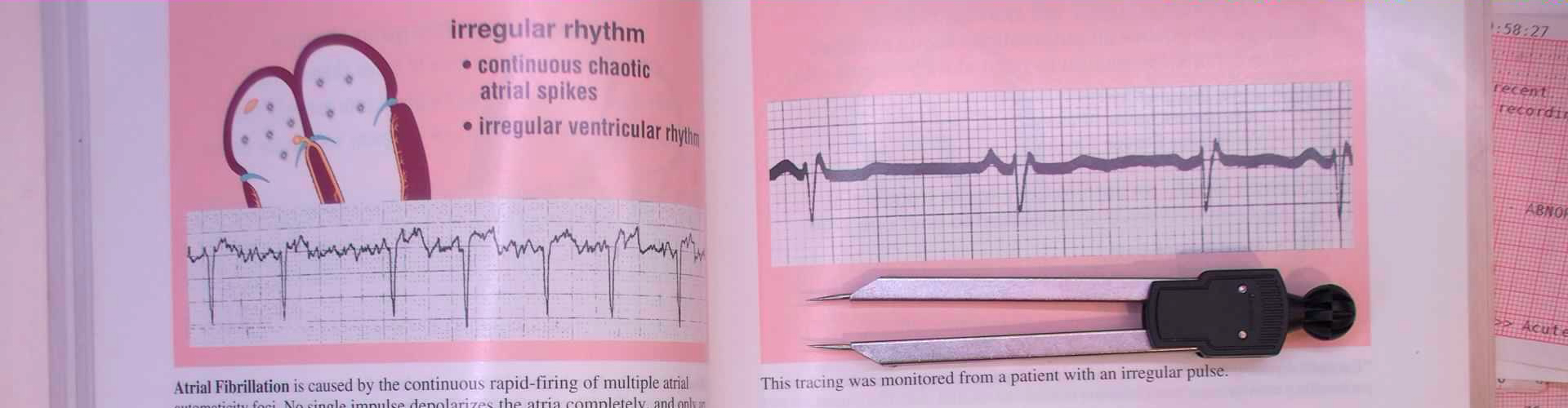 Inner page of Rapid Interpretation of EKG's showing quality of ECG reproductions.