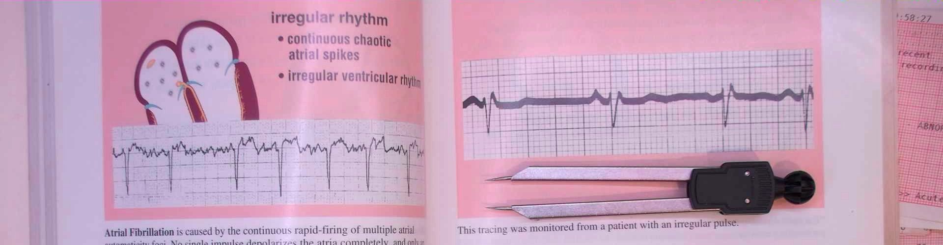 The Problem: How We Teach EKGs