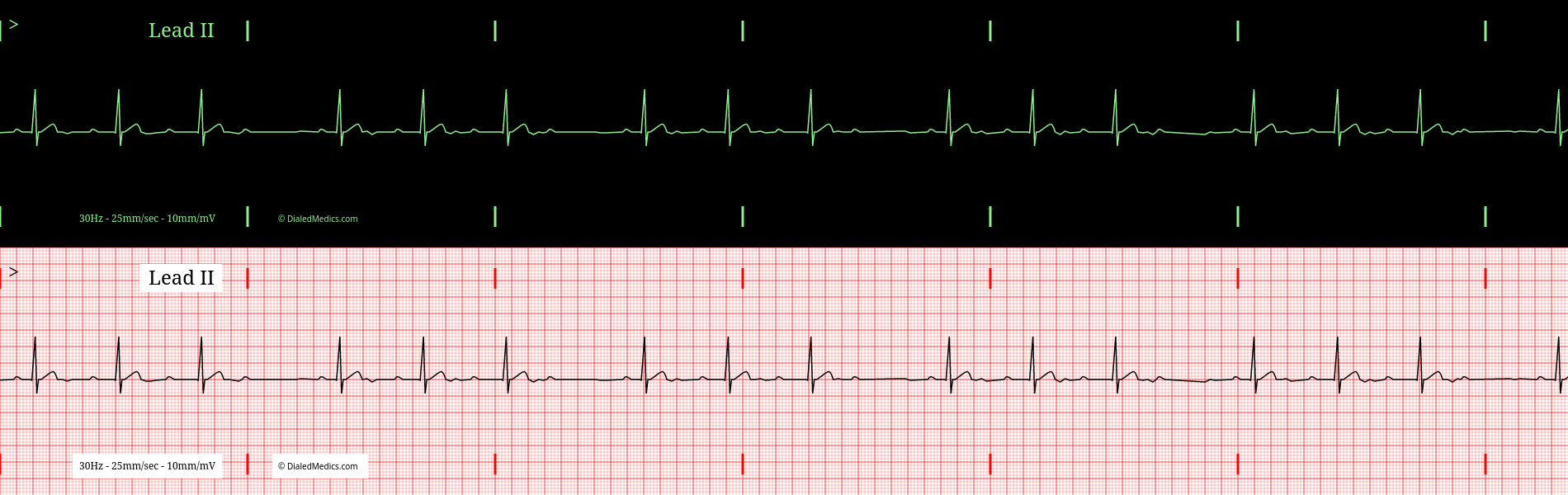 The Problem: How We Teach EKGs