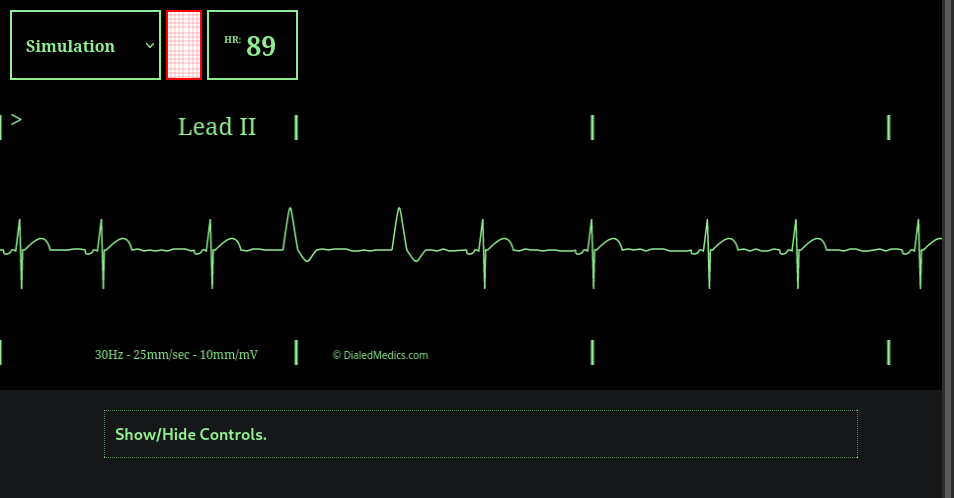 How To: EKG Simulator Quick Manual