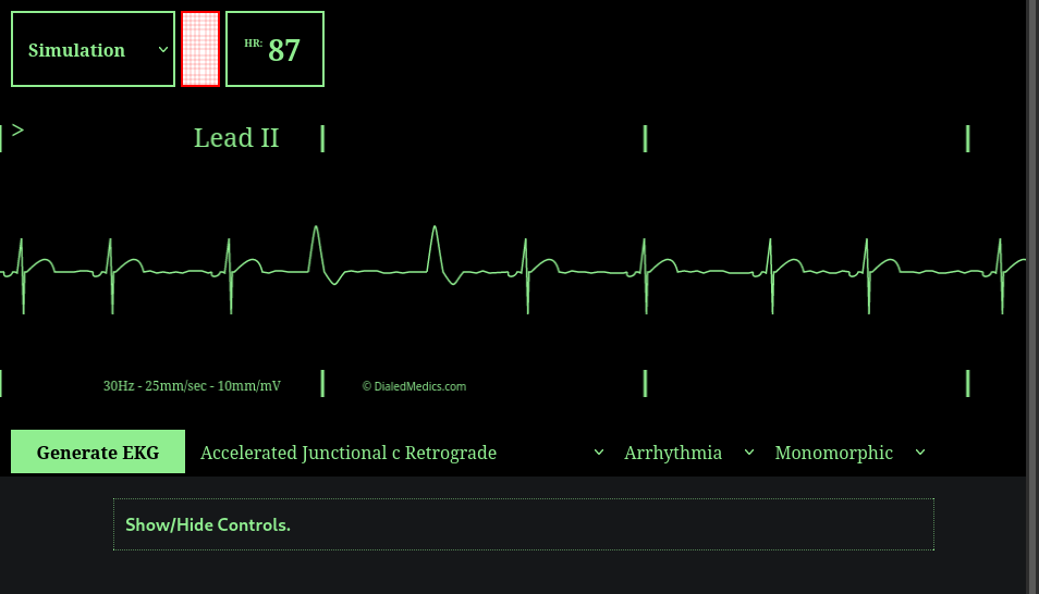 How To: EKG Simulator Quick Manual