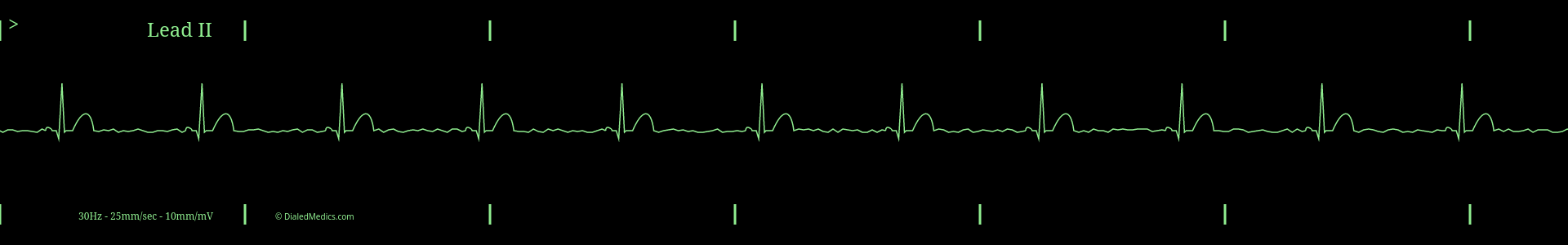 The Problem: How We Teach EKGs