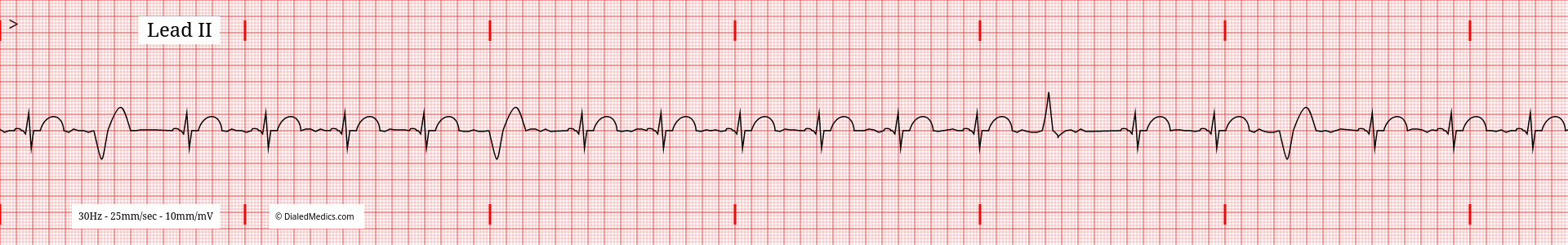The Problem: How We Teach EKGs