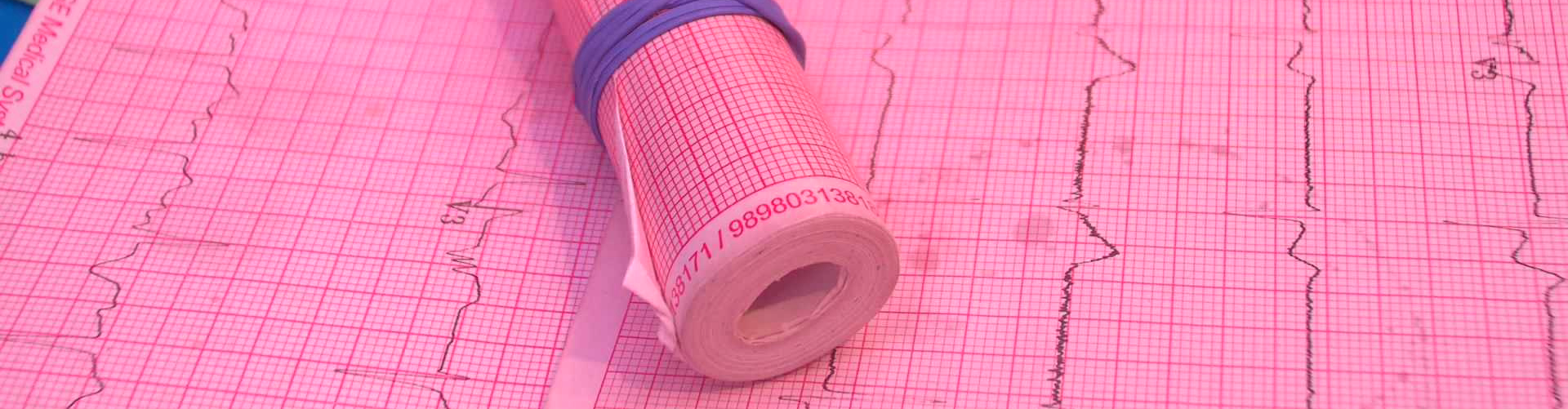 Tattered roll of ECG paper on a 12 Lead.