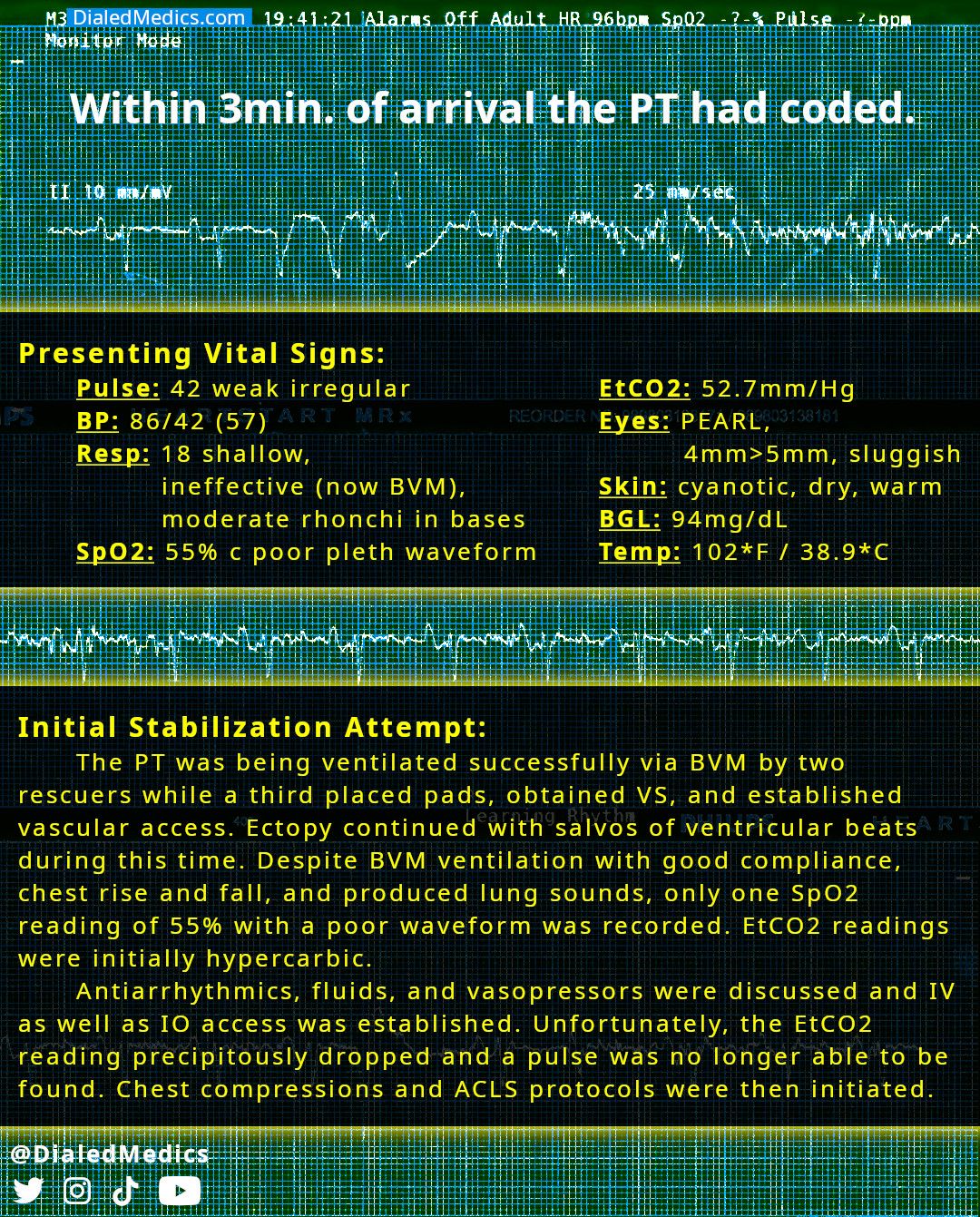 Initial vital signs, stabilization, and eventual loss of pulses.