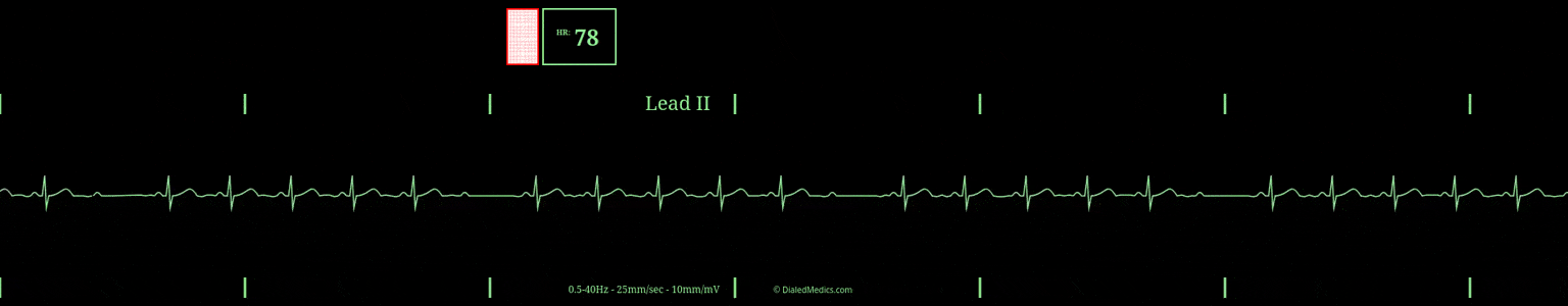 Our Solution: A software EKG generator