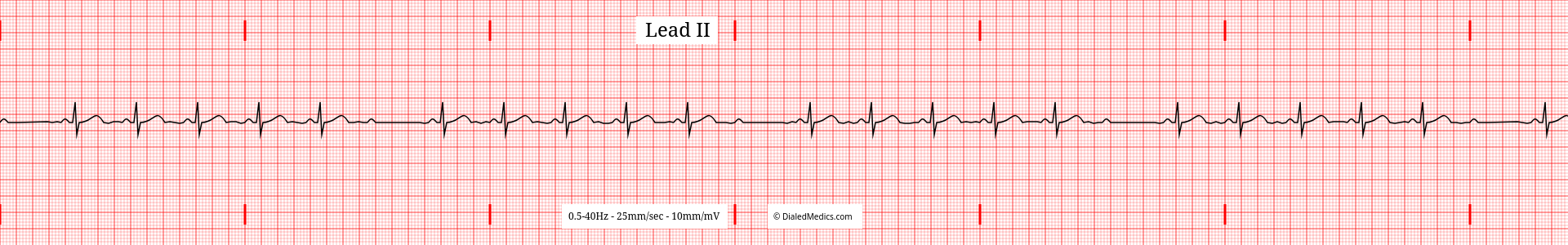Our Solution: A software EKG generator