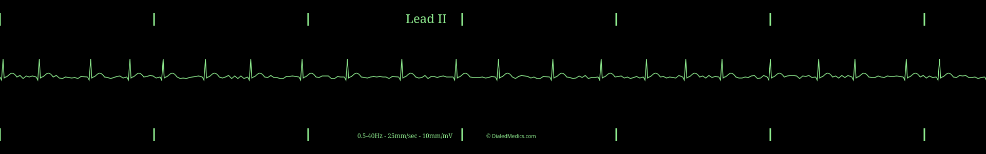 Our Solution: A software EKG generator