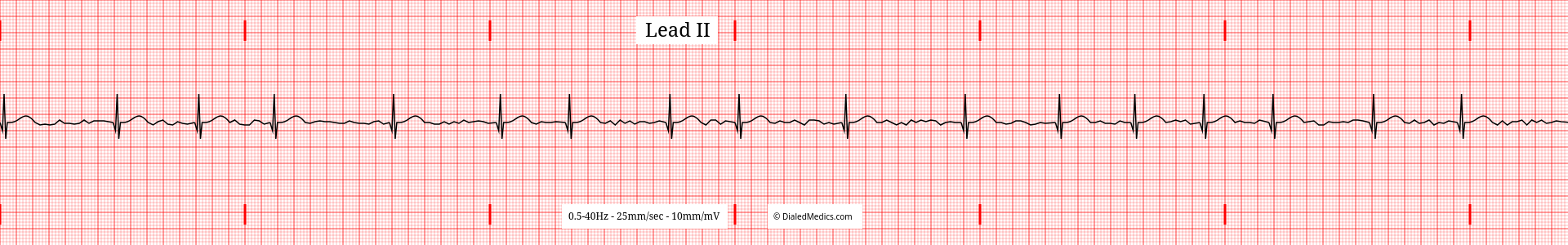 Our Solution: A software EKG generator