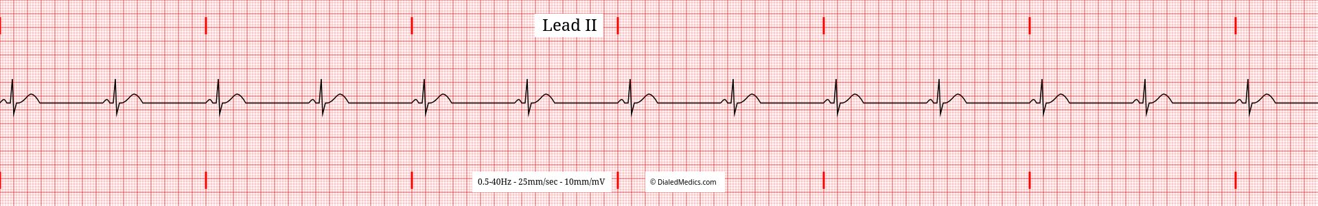 Our Solution: A software EKG generator