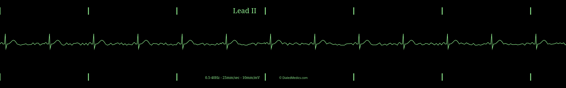 Our Solution: A software EKG generator