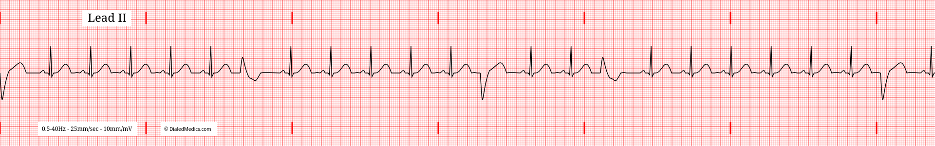 Our Solution: A software EKG generator