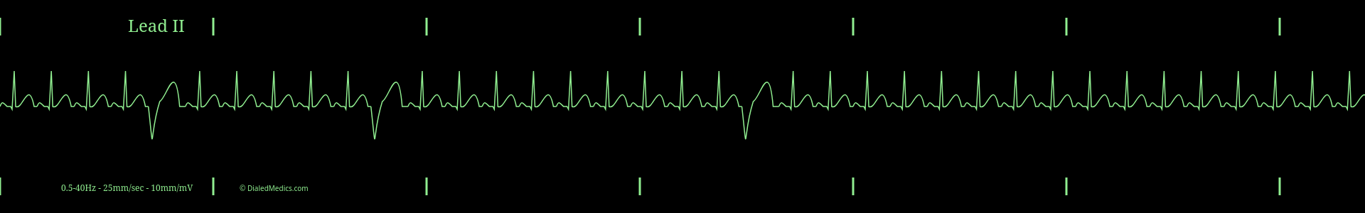 Our Solution: A software EKG generator